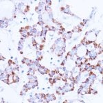 Microsomal Glutathione S-transferase 1 Rabbit anti-Human, Mouse, Rat,  Polyclonal, Novus Biologicals