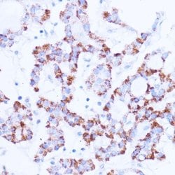 Microsomal Glutathione S-transferase 1 Rabbit anti-Human, Mouse, Rat, Polyclonal,