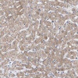Sirtuin 5/SIRT5 Antibody, Novus Biologicals:Antibodies:Primary Antibodies