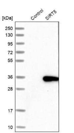 Sirtuin 5/SIRT5 Antibody, Novus Biologicals:Antibodies:Primary Antibodies