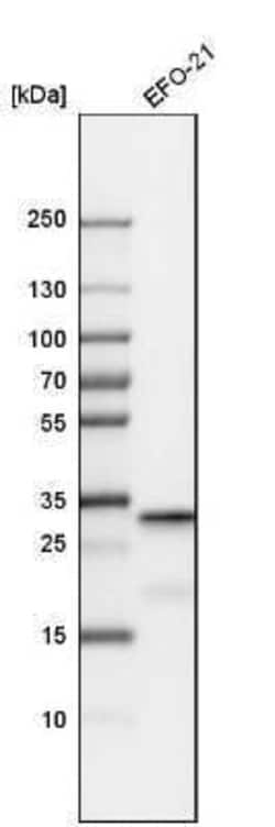 Sirtuin 5/SIRT5 Antibody, Novus Biologicals:Antibodies:Primary Antibodies