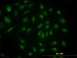 Skp1 Antibody (1H8), Novus Biologicals 0.1 mg | Buy Online | Novus Biologicals | Fisher Scientific