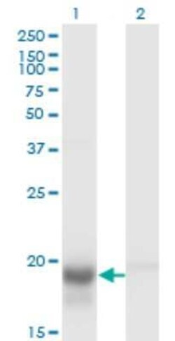 Skp1 Antibody (1H8), Novus Biologicals 0.1 mg | Buy Online | Novus Biologicals | Fisher Scientific
