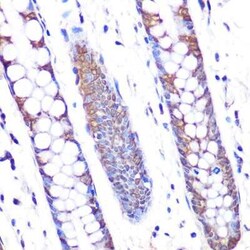 Skp2 Rabbit anti-Human, Mouse, Rat, Clone: 2L0K1, Novus Biologicals:Antibodies:Primary