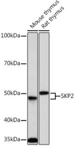 Skp2 Rabbit anti-Human, Mouse, Rat, Clone: 2L0K1, Novus Biologicals:Antibodies:Primary