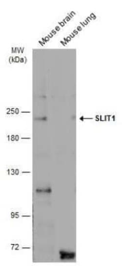 Slit1 Antibody, Novus Biologicals 100 &mu;g; Unconjugated:Antibodies, Polyclonal