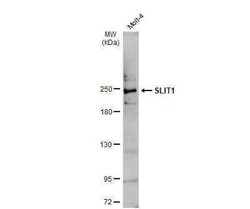 Slit1 Antibody, Novus Biologicals 100 &mu;g; Unconjugated:Antibodies, Polyclonal