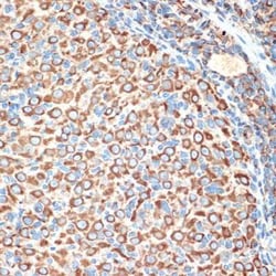 Slit2 Rabbit anti-Human, Mouse, Rat, Clone: 1T5A3, Novus Biologicals:Antibodies:Primary