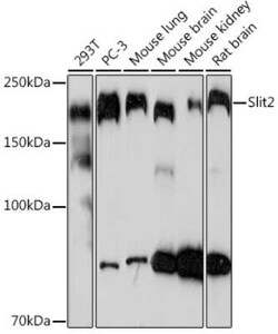 Slit2 Rabbit anti-Human, Mouse, Rat, Clone: 1T5A3, Novus Biologicals:Antibodies:Primary