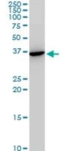 Slug Antibody (3C12), Novus Biologicals 0.1 mg | Buy Online | Novus Biologicals | Fisher Scientific