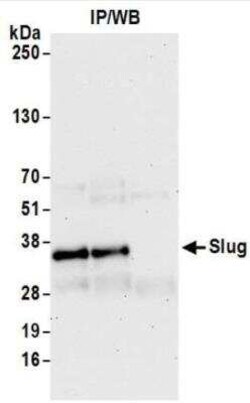 Slug Antibody (BLR139H), Novus Biologicals 100 &mu;g | Buy Online | Bio-Techne | Fisher Scientific