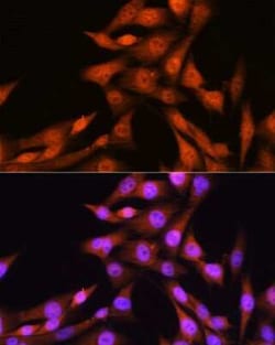 Smad1 Rabbit anti-Human, Mouse, Clone: 4W2M9, Novus Biologicals 20 &mu;g | Buy Online | Novus Biologicals | Fisher Scientific