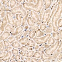 Smad1 Rabbit anti-Human, Mouse, Clone: 4W2M9, Novus Biologicals 20 &mu;g | Buy Online | Novus Biologicals | Fisher Scientific