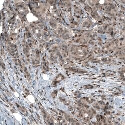 Smad2 Antibody (CL8472), Novus Biologicals 100 &mu;L; Unconjugated:Antibodies,