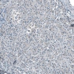 Smad2 Antibody (CL8472), Novus Biologicals 100 &mu;L; Unconjugated:Antibodies,