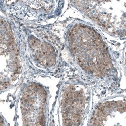 Smad2 Antibody (CL8472), Novus Biologicals 100 &mu;L; Unconjugated:Antibodies,