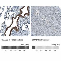Smad2 Antibody (CL8472), Novus Biologicals 100 &mu;L; Unconjugated:Antibodies,