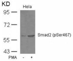 Smad2, p Ser467 Antibody - BSA Free, Novus Biologicals Smad2 Antibody;