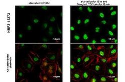 Smad2, p Ser465, p Ser467 Antibody, Novus Biologicals 100 &mu;g | Buy Online | Novus Biologicals | Fisher Scientific