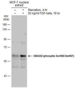 Smad2, p Ser465, p Ser467 Antibody, Novus Biologicals 100 &mu;g | Buy Online | Novus Biologicals | Fisher Scientific