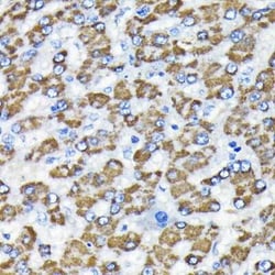 Smad3 Rabbit anti-Human, Mouse, Rat, Clone: 7L6K7, Novus Biologicals:Antibodies:Primary