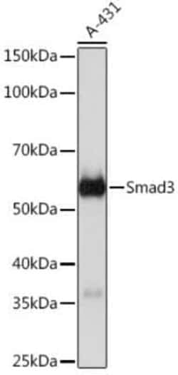 Smad3 Rabbit anti-Human, Mouse, Rat, Clone: 7L6K7, Novus Biologicals:Antibodies:Primary