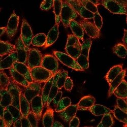 Smad3 Mouse anti-Human, Clone: PCRP-SMAD3-1A2, Novus Biologicals:Antibodies:Primary