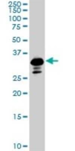 Smad3 Antibody (7F3), Novus Biologicals 0.1 mg | Buy Online | Novus Biologicals | Fisher Scientific