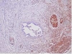 Smad4 Rabbit anti-Human, Mouse, Rat, Clone: SMAD/6309R, Novus Biologicals:Antibodies:Primary