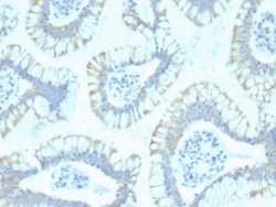 Smad4 Mouse anti-Human, Clone: SPM448, Novus Biologicals 20 &mu;g; Unconjugated:Antibodies,