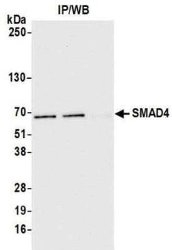 Smad4 Antibody (BLR133J), Novus Biologicals 100 &mu;g | Buy Online | Novus Biologicals | Fisher Scientific