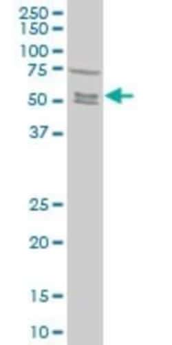 Novus Biologicals Smad5 Antibody (4F10), Novus Biologicals 0.1 mg | Buy Online | Novus Biologicals&trade; | Fisher Scientific