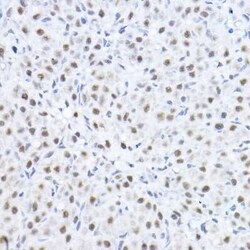Smek1 Antibody - BSA Free, Novus Biologicals 0.1 mL; Unconjugated:Antibodies,