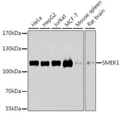 Smek1 Antibody - BSA Free, Novus Biologicals 0.1 mL; Unconjugated:Antibodies,