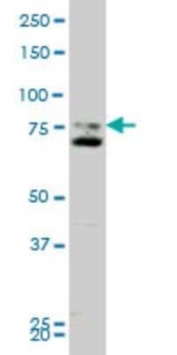 Smoothened Antibody (1D9), Novus Biologicals 0.1 mg; Unconjugated:Antibodies,