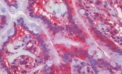 Smoothened Antibody, Novus Biologicals 50 &mu;g | Buy Online | Novus Biologicals | Fisher Scientific