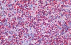 Smoothened Antibody, Novus Biologicals 50 &mu;g | Buy Online | Novus Biologicals | Fisher Scientific