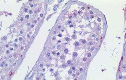 Smoothened Antibody, Novus Biologicals 50 &mu;g | Buy Online | Novus Biologicals | Fisher Scientific