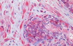 Smoothened Antibody, Novus Biologicals 50 &mu;g | Buy Online | Novus Biologicals | Fisher Scientific