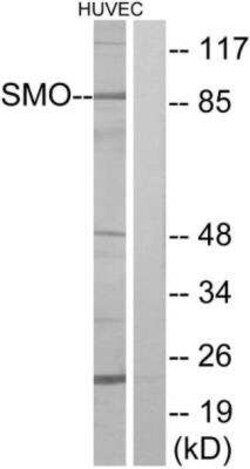 Smoothened Antibody, Novus Biologicals 50 &mu;g | Buy Online | Novus Biologicals | Fisher Scientific