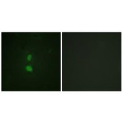 Snail, p Ser246 Antibody, Novus Biologicals:Antibodies:Primary Antibodies