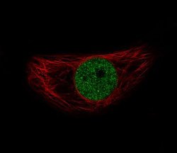 Snail Antibody (CL3700), Novus Biologicals 100&mu;L:Antibodies, Monoclonal