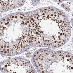 Snail Antibody (CL3700), Novus Biologicals 100&mu;L:Antibodies, Monoclonal
