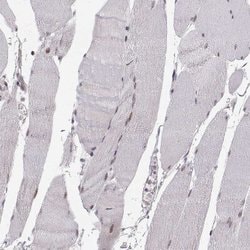 Snail Antibody (CL3700), Novus Biologicals 100&mu;L:Antibodies, Monoclonal