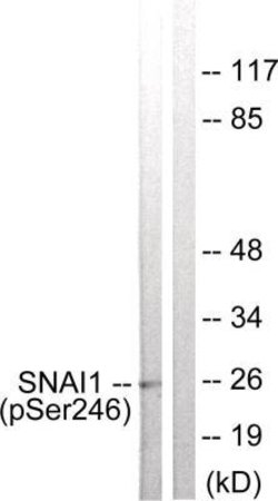 Snail, p Ser246 Antibody, Novus Biologicals:Antibodies:Primary Antibodies