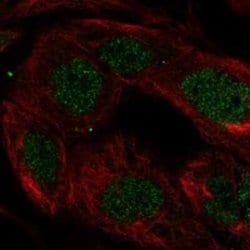 SnoN Rabbit anti-Human, Polyclonal, Novus Biologicals 25 &mu;g | Buy Online | Novus Biologicals | Fisher Scientific