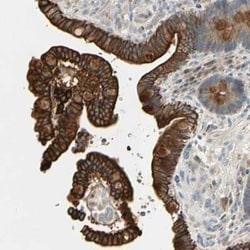 SnoN Antibody, Novus Biologicals:Antibodies:Primary Antibodies