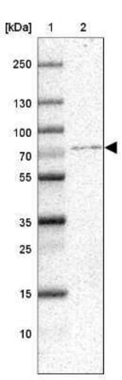 SnoN Antibody, Novus Biologicals:Antibodies:Primary Antibodies