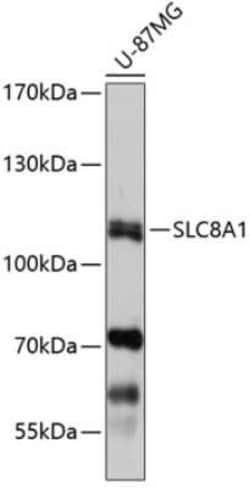 Sodium Calcium Exchanger 1/NCX1 Antibody - Azide and BSA Free, Novus Biologicals