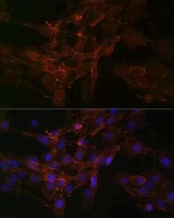 Sodium Potassium ATPase Alpha 1 Rabbit anti-Human, Mouse, Rat, Clone: 3L6F0,